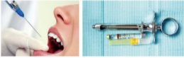 胰島素，牙科麻醉6.png